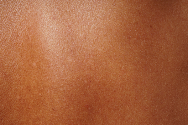 Understanding common skin concerns