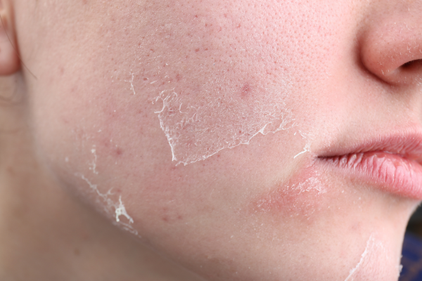 Finding the right approach to skin health